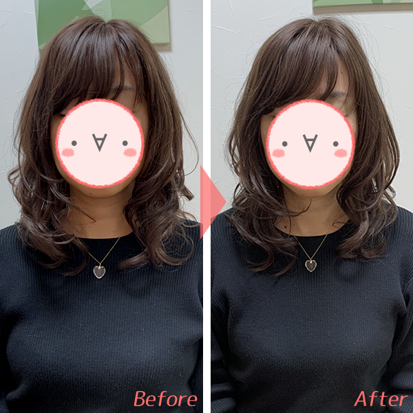 医療用ウィッグのこめかみ部分あたりを留めると、顔まわりもすっきりとした印象に