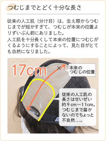 医療用ウィッグストーリー 医療用ウィッグの人工肌のチェックポイント