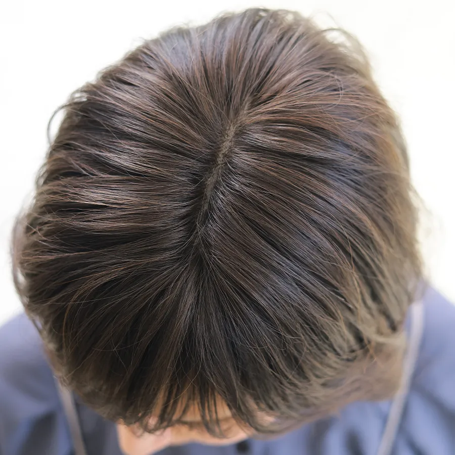 ×pEBbO Xg[[̃AȕڂƎRȂނ