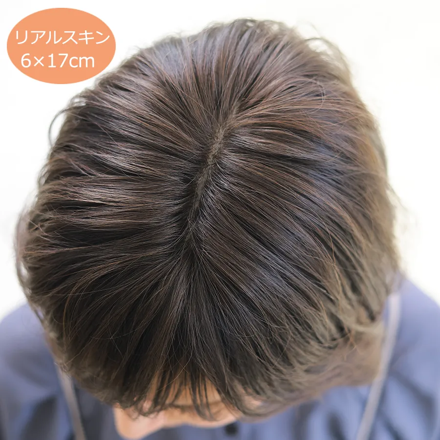 医療用ウィッグストーリー/リアルスキン/自然なつむじ